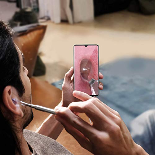 Ear Wax Removal Tool, Ear Spoon, Ear Pick for Anykit NTE430, NTE100i Otoscope...