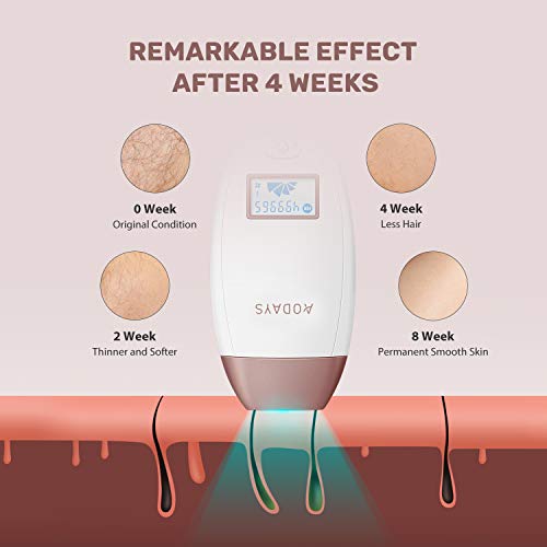 AODAYS IPL Hair Removal Device, Permanent Hair Removal 500,000 Flashes Painle...