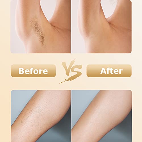 Hair Removal for Women and Men, Upgraded 999,900+ Flashes Permanent Painless ...