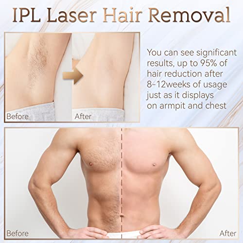 IPL Hair Removal, Laser Permanent Hair Removal for Women and Men, 999900 Flas...
