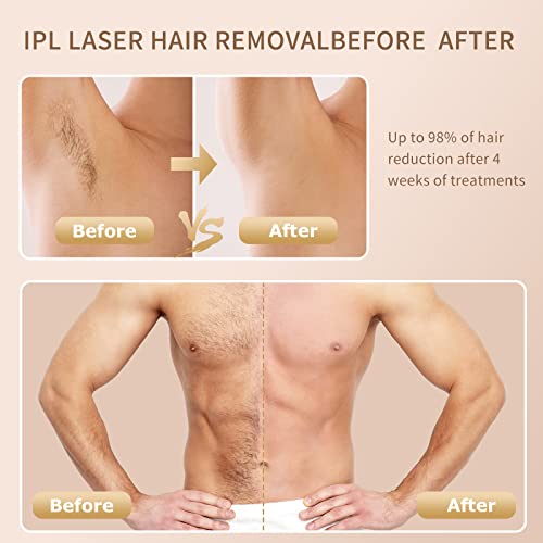 Laser Hair Removal for Women and Men with Sapphire Cooling, Newest Upgraded 9...