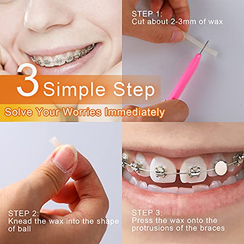 Aoutrow12 PACK Braces Wax Dental Wax with Colorful Storage Cases, 60 Orthodon...