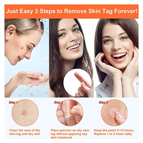 Skin Tag Remover Patches - (108 Pcs) Natural and Fast-Acting Skin Remover Pat...