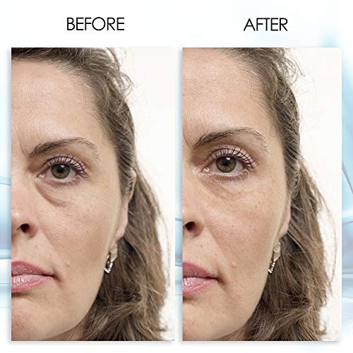 Puffy Eye GEL Instant results – Naturally rapid reduction eye gel, Eliminate ...