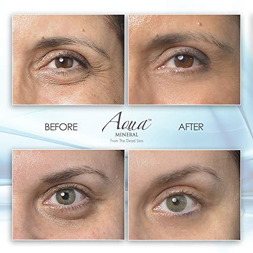 Puffy Eye GEL Instant results – Naturally rapid reduction eye gel, Eliminate ...