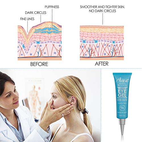 Puffy Eye GEL Instant results – Naturally rapid reduction eye gel, Eliminate ...