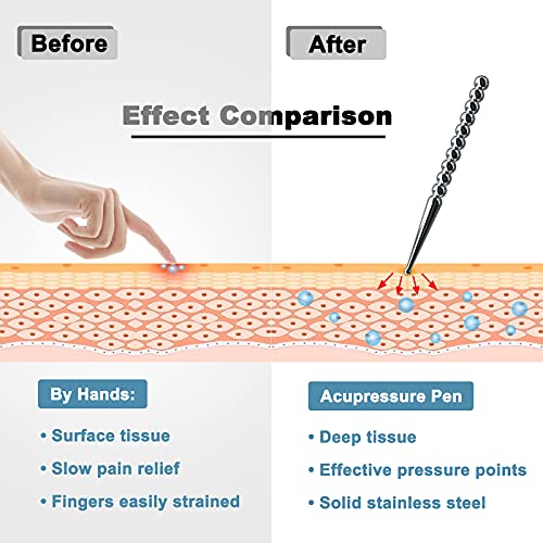 ARGOMAX - Manual Acupuncture Pen Massage Deep Tissue Tool