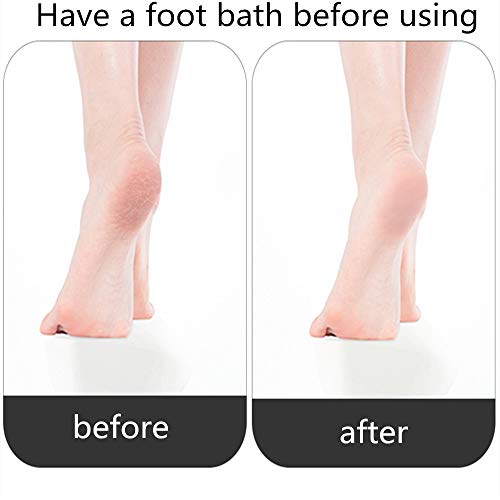 4Pack Handle Pumice Toilet Cleaning Stones Pumice Sticks Hard Water Ring Remo...