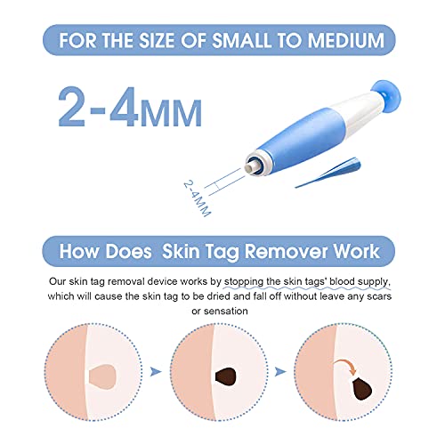 Skin Tag Remover, Skin Tag Removal Kit Tools with 36Pcs Repair Patches for Mi...