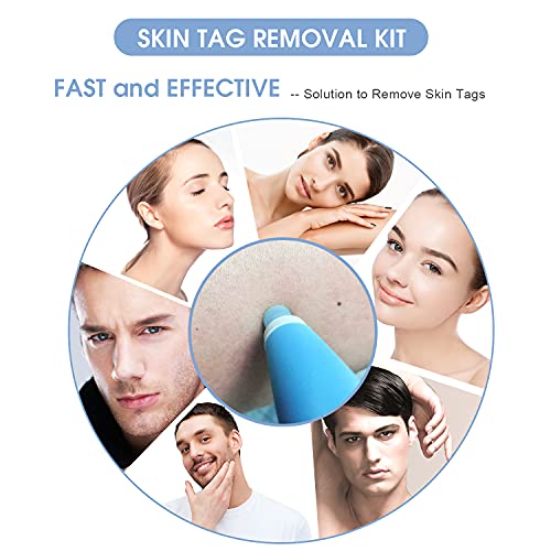 Skin Tag Remover, Skin Tag Removal Kit Tools with 36Pcs Repair Patches for Mi...