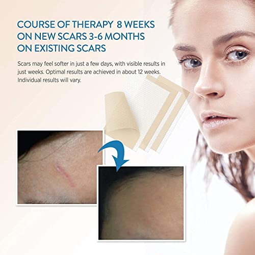 Aroamas Professional Silicone Scar Sheets, Soften and Flattens Scars Resultin...
