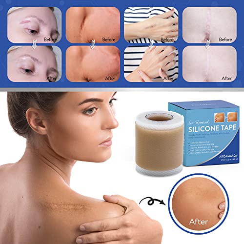Aroamas Scar Silicone Scar Sheets Silicone Scar Tape 1.6x60" for Softening an...