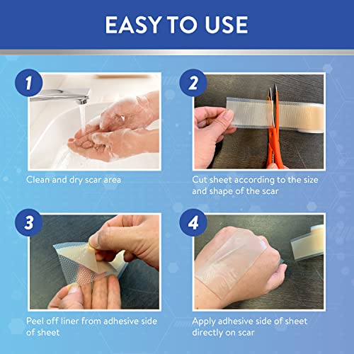 Aroamas Scar Silicone Scar Sheets Silicone Scar Tape 1.6x60" for Softening an...