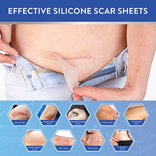 Aroamas Scar Silicone Scar Sheets Silicone Scar Tape 1.6x60" for Softening an...