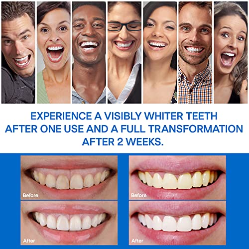 Teeth Whitening & Bright Strips, 32 White Strips Teeth Whitening Kit, Non-Sen...