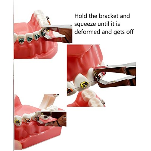 Bracket Removing Pliers Braces Removing Pliers Orthodontic Dental by Wise Lin...