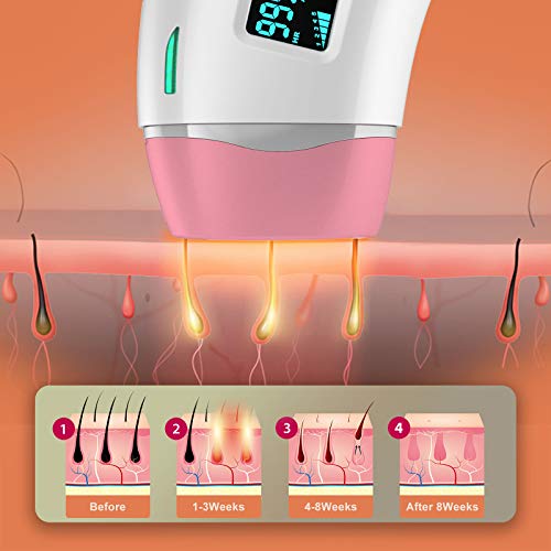 IPL Hair Removal for Women and Men, Permanent Laser Hair Remover device Upgra...