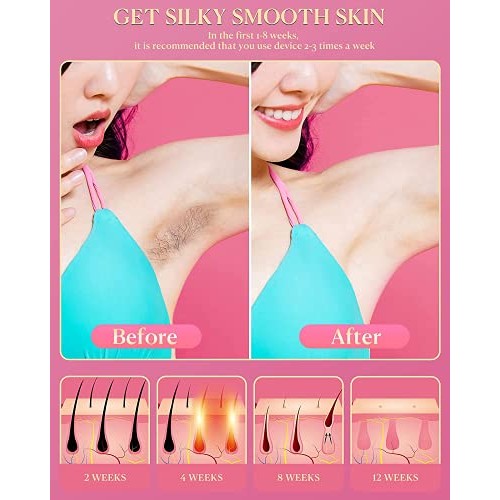 Laser Hair Removal for Women, Permanent Hair Removal Facial Painless at-Home ...