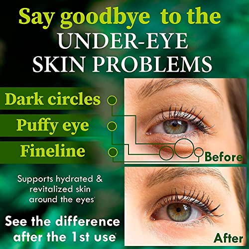 Under Eye Mask for Puffy Eyes, Dark Circles, Eye Bags, Wrinkles, Puffiness wi...
