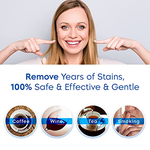 AsaVea Teeth Whitening Pen - Comfortable and Convenient Teeth Whitening at Ho...