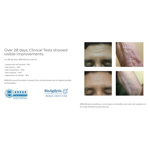 ASEA Renu 28 Revitalizing Redox Gel 2 pk - 6 Fl oz