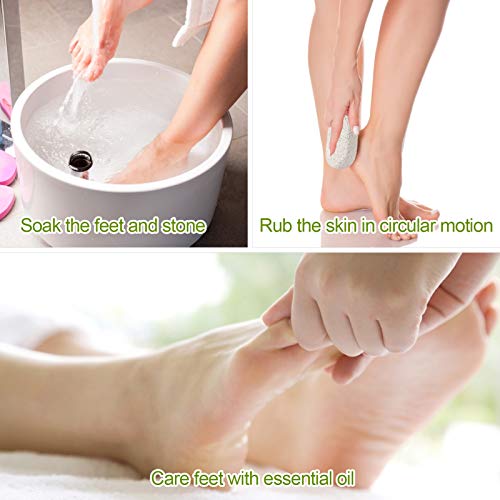 2PCS Natural Pumice Stone for Feet - Asqraqo Lava Pedicure Tools Hard Skin Ca...