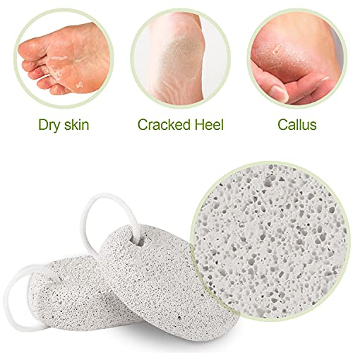 2PCS Natural Pumice Stone for Feet - Asqraqo Lava Pedicure Tools Hard Skin Ca...