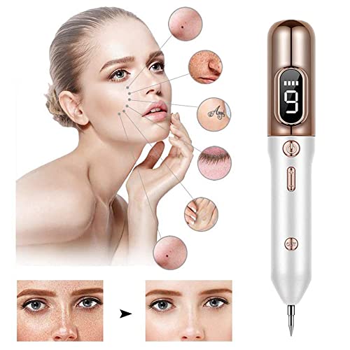 Portable Beauty Equipment Skin Tag Remover Home Usage USB Charging Gift Ideal...