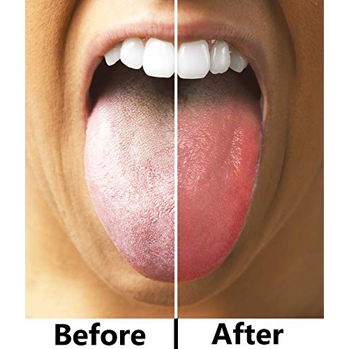 Atmiko Tongue Scraper, Ayurvedic Tongue Cleaner (Pack of 2) Pure Copper Metal...