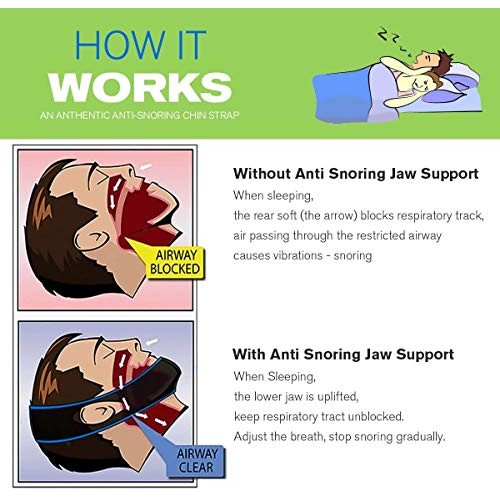 Anti Snoring Chin Straps,Ajustable Stop Snoring Solution Snore Reduction Slee...