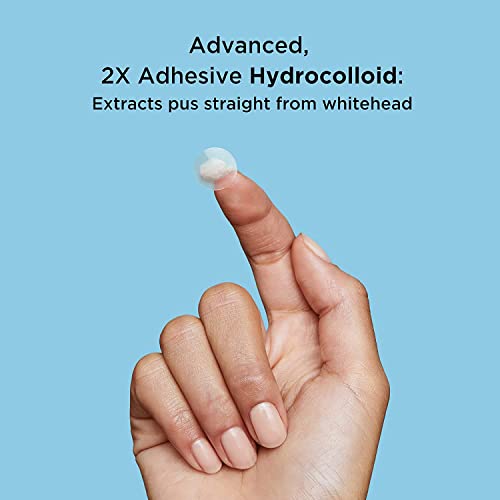 Avarelle Pimple Patches (40 Count) Hydrocolloid Acne Patches, Acne Spot Treat...
