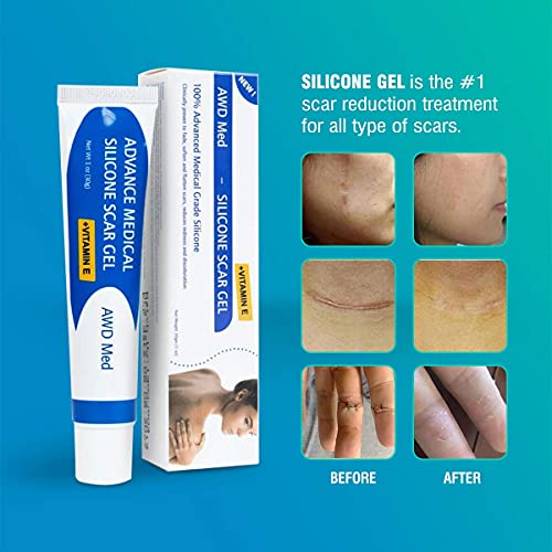 AWD Advanced Silicone Gel Medical Grade - Old & New Scar Removal Gels for Sur...