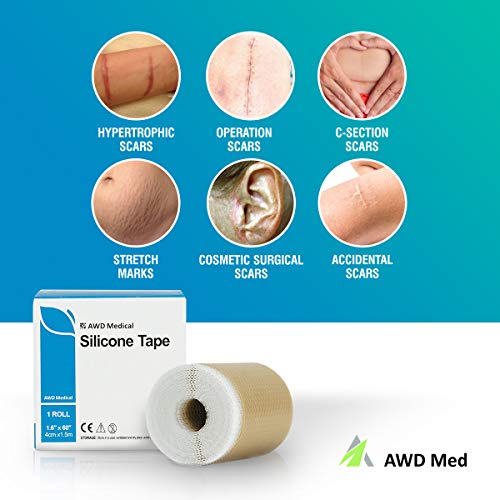 AWD Medical Grade Soft Silicone Gel Tape for Scar Removal (1.6” x 60”) Highly...
