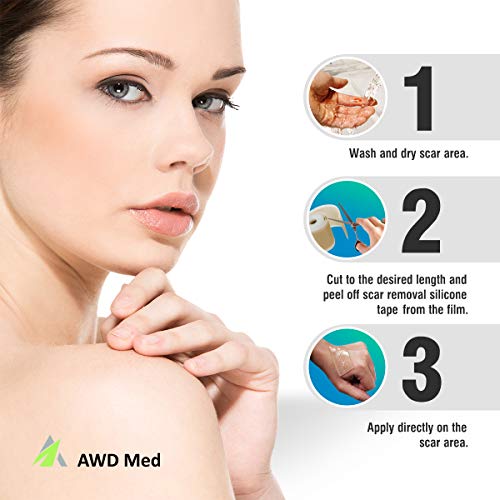 AWD Medical Grade Soft Silicone Gel Tape for Scar Removal (1.6” x 60”) Highly...