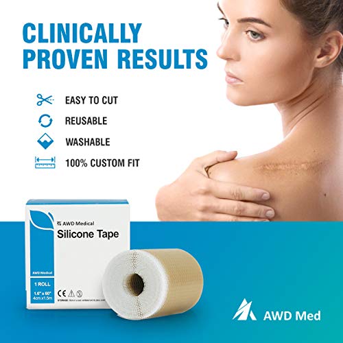 AWD Medical Grade Soft Silicone Gel Tape for Scar Removal (1.6” x 60”) Highly...