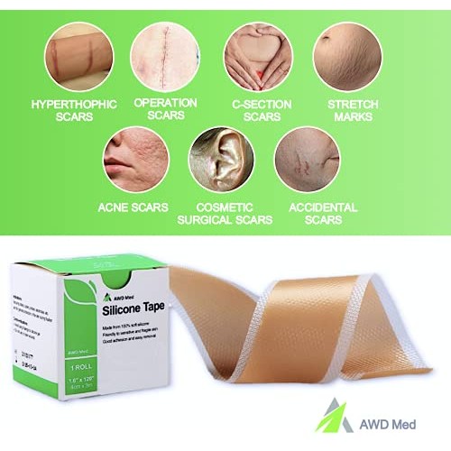 AWD Silicone Scar Sheets, Soft Silicone Scar – 1.6” x 120” – Reusable Painles...
