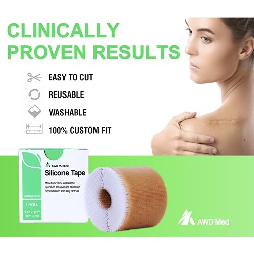 AWD Silicone Scar Sheets, Soft Silicone Scar – 1.6” x 120” – Reusable Painles...