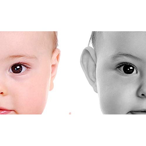 Aesthetic correctors for protruding ears 8 units.