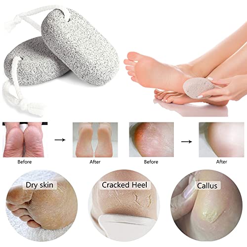 Pumice Stone for Feet, 3 PCS Natural Foot Pumice Stone, Lava Pedicure Tools H...