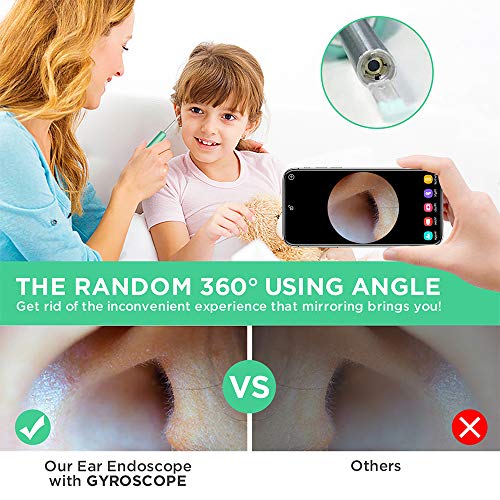 Ear Wax Removal Endoscope, Upgraded Heads 1080P FHD Ear Cleaner Wireless Ear ...