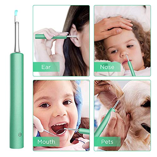 Ear Wax Removal Endoscope, Upgraded Heads 1080P FHD Ear Cleaner Wireless Ear ...
