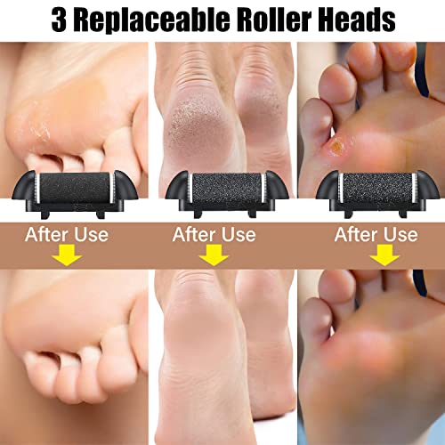 Electric Callus Remover for Feet, Rechargeable Foot File Callus, Professional...