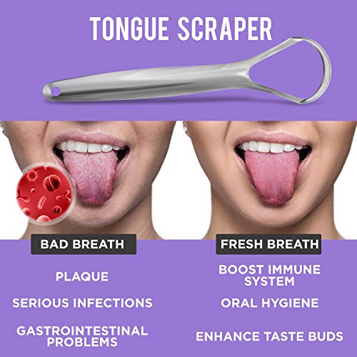 Tongue Scraper (2 Pack), Reduce Bad Breath (Medical Grade), Stainless Steel T...