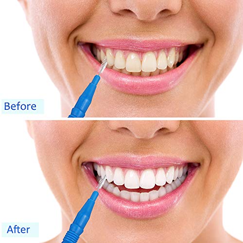 100 Pieces Braces Brush for Cleaner Interdental Brush Toothpick Dental Tooth ...