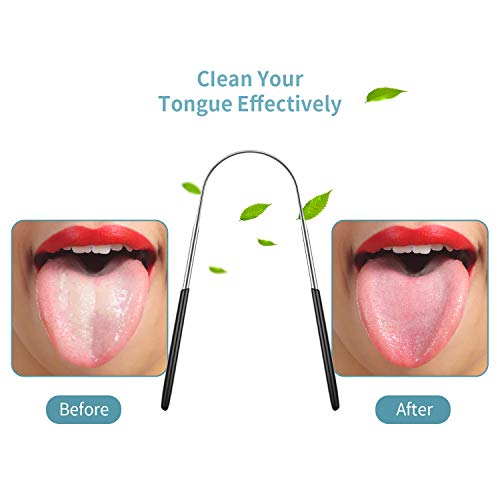 4 Pieces Tongue Scrapers,Reduce Bad Breath Tongue Scrapers for Adults Kids St...