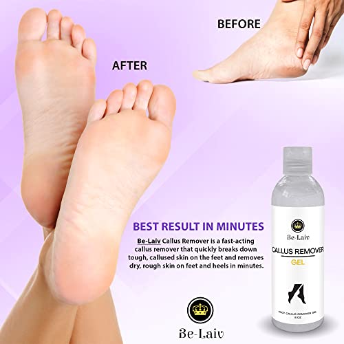 Be-Laiv 8 oz. Foot Callus Remover Gel - Callous Removers for Feet - Foot Call...