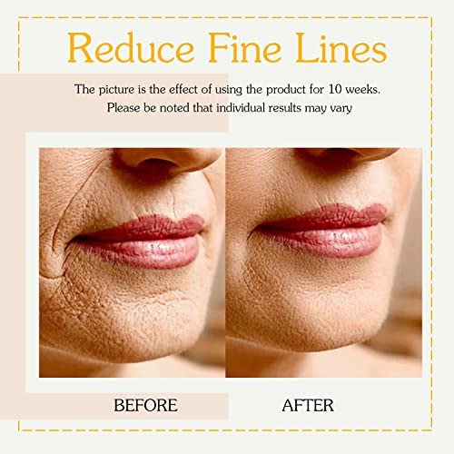 Retinol Collagen Cream with Hyaluronic Acid for Face Moisturizing and Anti Ag...