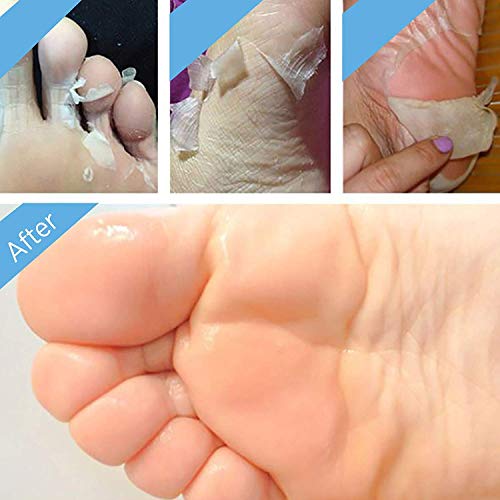 2 Pairs Foot Peel Mask Exfoliant for Soft Feet in 1-2 Weeks, Exfoliating Boot...