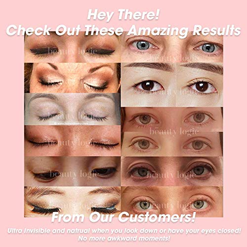 Beauty Logic Aqua Lace Eyelid Lifting Kit, 120 Invisible Lifter Tape Strips, ...