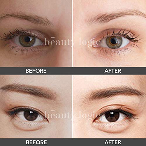 Beauty Logic Aqua Lace Eyelid Lifting Kit, 120 Invisible Lifter Tape Strips, ...
